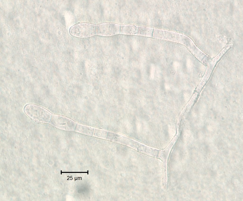 Podosphaera erigerontis-canadensis Figure 4